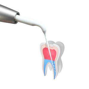 2/4 lỗ nha khoa kích hoạt thủy lợi Perio mở rộng quy mô không khí tay khoan <span class=keywords><strong>5</strong></span> Mẹo Làm Sạch Răng dụng cụ nha khoa tuabin - Product Image 6