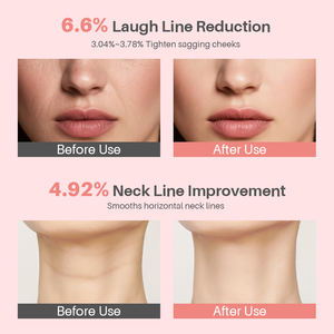 <span class=keywords><strong>Baume</strong></span> Visage Anti-rides au Collagène PDRN de Saumon – Hydratation Longue Durée pour Peaux Sèches et Vieillissantes – Soin des Yeux Hivernal - Product Image 5