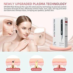 YOUMAY Pele Portátil Tag Pen Remover para Mole, verruga e Tag Pele para Mulheres e Meninas OPHERA - Product Image 2