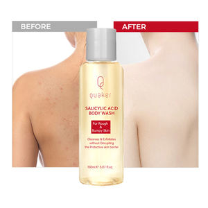 جل استحمام من Qquaker بزيت حمض الساليسيليك للتحكم في غسل الجسم مضاد لحب الشباب والرؤوس السوداء يزيل الرؤوس السوداء ولا رائحة لبشرة الفراولة - Product Image 4