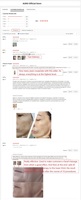 Appareil de lifting facial BIO galvanique anti-points noirs et anti-rides Au-8403-V4 2022 avec gants micro-courants et dispositif de tonification faciale micro-courant