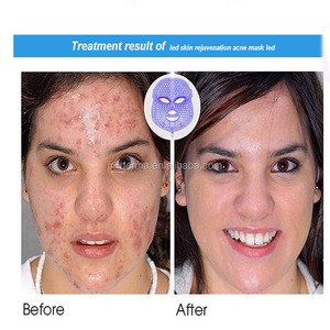 Máscara - Product Image 6