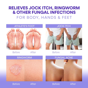 Jabón antibacteriano de lavanda <span class=keywords><strong>natural</strong></span> y árbol de té de etiqueta privada | Barra facial corporal hidratante antiacné hecha a mano para limpieza profunda - Product Image 4