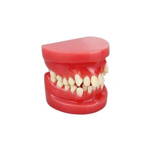 Modelo de Maloclusión Dental para Prácticas de Estudiantes de Odontología, Enseñanza, Entrenamiento, Comunicación, Equipo Médico Bucal - Product Image 5