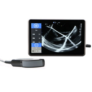 Échographe Doppler Couleur Portable Étanche IPX6 ECI-X7 pour Usage Vétérinaire avec Affichage B/C/PW, Utilisation Facile, Téléchargement sans Fil via WIFI - Product Image 2
