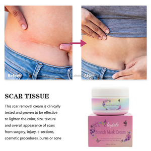 Crema Reparadora de Estrías de Marca Privada para el Cuidado de la Piel, Eliminación de Cicatrices del Embarazo, Crema Natural de Manteca de Karité para el Abdomen - Product Image 3