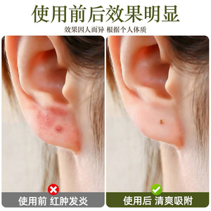 แท่งไม้ชาเขียว ชาแดง แท่งไม้ธรรมชาติสำหรับดูแลใบหู สำหรับผู้หญิง ใส่นอนได้ ต่างหูแบบซ่อนได้ - Product Image 5