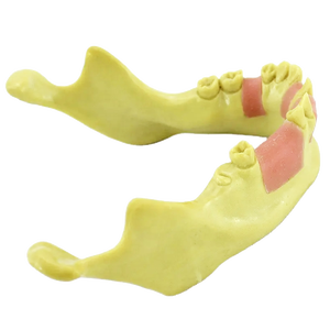 Medico <span class=keywords><strong>e</strong></span> Dentale modello di impianto dentale <span class=keywords><strong>mascella</strong></span> <span class=keywords><strong>mandibola</strong></span> dentale modello di impianto denti modello ganasce - Product Image 5