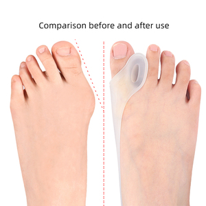SEBS Toe Separator Foot Straightener <strong>Bunion</strong> <strong>Protector</strong> and Halux Valgus Cover Splint and Wrap for Thumb and Toe - Product Image 2