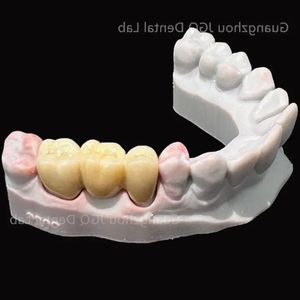 Prothèses dentaires en <span class=keywords><strong>zircone</strong></span> toutes les couronnes et ponts en céramique de haute qualité, bonne biocompatibilité et prix abordable - Product Image 4