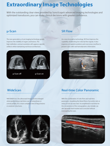Sonoscape P11Elite 4D/5D Trolley Máquina <span class=keywords><strong>de</strong></span> ultrasonido Doppler a color <span class=keywords><strong>para</strong></span> venas, bebé, abdomen - Product Image 3
