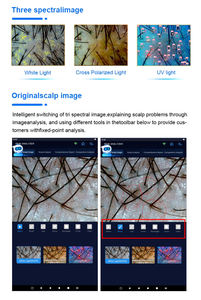 Analizador de Piel Profesional O1-PRO 2026, Imágenes Multiespectrales de 30MP, Inteligencia Artificial, Tecnología 3D, Análisis Facial y Corporal, UE - Product Image 6