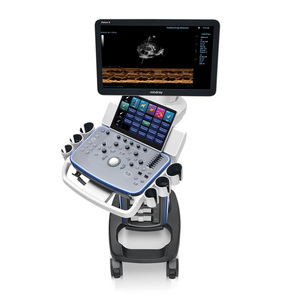 Système d'échographie vétérinaire Mindray Vetus 5 avec moniteur LED HD de 21,5 pouces et écran tactile de 13,3 pouces - Product Image 4