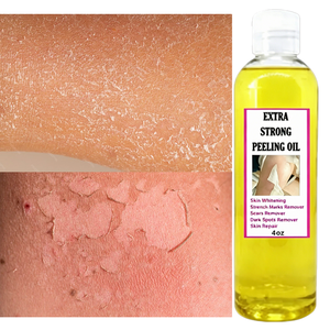 Huile Exfoliante Correctrice Vergetures Cicatrices Taches Brunes Éclaircissante Réparatrice Camélia Camomille Réglisse 110ml - Product Image 1