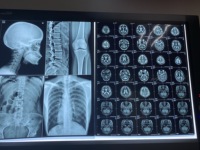 Impresora de Película Térmica para Rayos X para Película de Rayos X Médica y No Médica Fuji