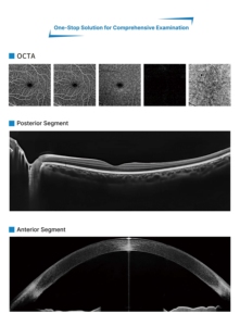 Máquina OCT Avanzada para Diagnóstico Clínico de <span class=keywords><strong>AMD</strong></span>, <span class=keywords><strong>DR</strong></span> y PCV, OCTA80 - Product Image 6