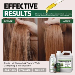 Huile Essentielle de <span class=keywords><strong>Romarin</strong></span> 100% Pure, Biologique et Premium pour l'Aromathérapie, la Croissance Capillaire et les Soins du Cuir Chevelu – Vente en Gros, Échantillon Gratuit - Product Image 3