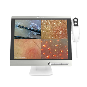 Máquina Analizadora de Cuero Cabelludo HD Multilingüe de Alta Calidad para el Análisis de Problemas Capilares - Product Image 1