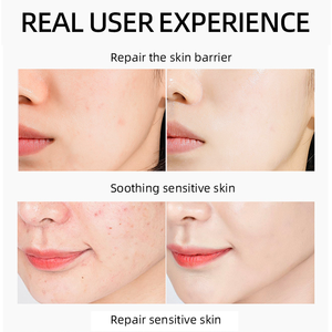 מותאם אישית 50 מ "ל אופתלמולוגי ג 'ל עיצוב אקרילי עור ארוך טווח עם מקור - Product Image 4