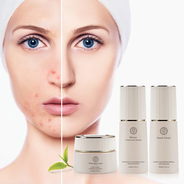Perfectcare Private Label Organic Korean Facial Skin Care Set Spot Removal Whitening Brightening Acne Skin Care Set