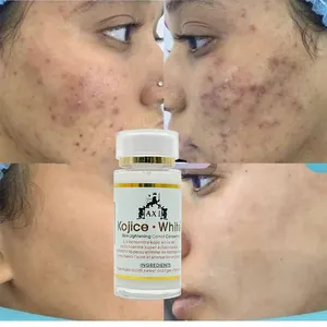 Concentre Kojic sérum éclaircissant blanc avec traitement de l'acné aux vitamines C élimine les taches brunes et les boutons pour le sérum de soin anti-âge - Product Image 1