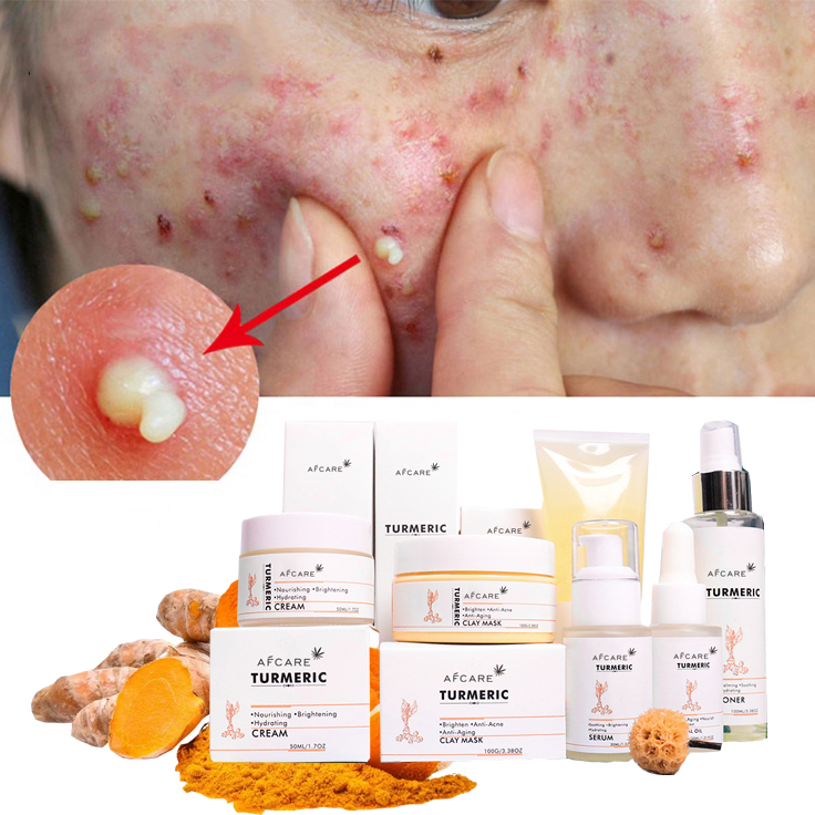 Custom Private Label Organic Korean Face Care Product Anti Aging Remove Acne Turmeric Skin Care Set