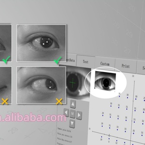 Analizador de Campo Visual Óptico Perimetral de Proyección Cinética EOBBIO12, el Más Popular y Económico, con Función de Importación de Datos Históricos ZEISS - Product Image 6