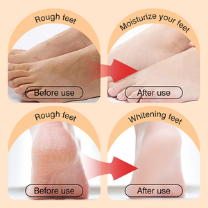 Masque exfoliant hydratant et réparateur au gingembre pour les pieds, marque privée ZOZU, vente chaude - Product Image 4