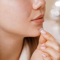 Cerotti Idrocolloidali per Acne all'Olio di Tea Tree, Personalizzati con Glitter per il Viso, Confezione da 48, Ipoallergenici, Certificati ISO/CE