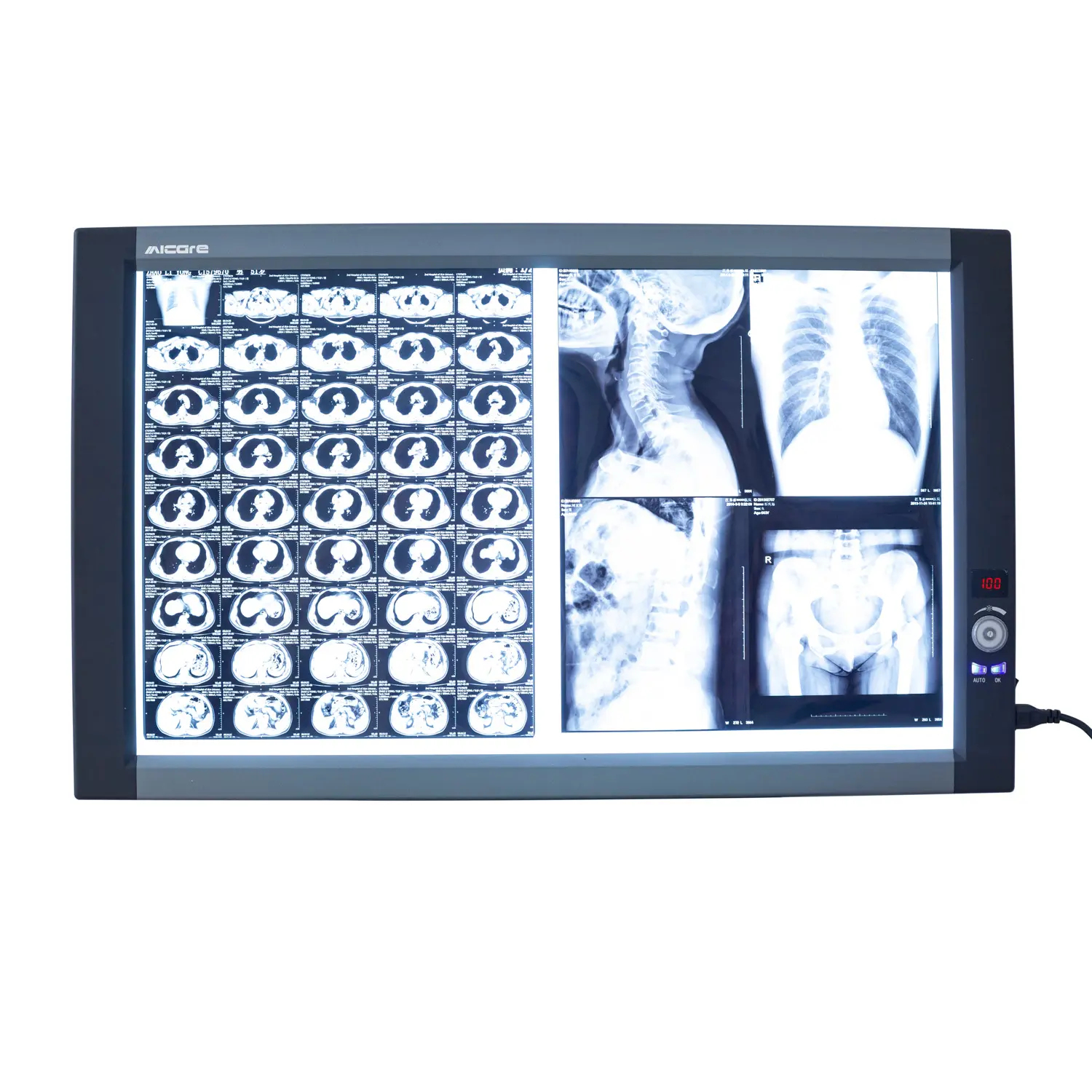 Ayarlanabilir tıbbi LED X Ray cihaz pan görüntüleme filmi görüntüleyici görüş kutusu xray görüntüleyici çift panel led negatoskop negatoskop x ray