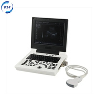 Appareil d'échographie vétérinaire électrique avec système Windows 7/sonde convexe/vaginale, échographie portable pour animaux gestants