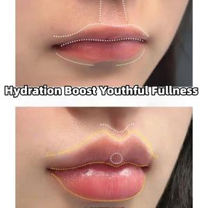 Ampollas <span class=keywords><strong>de</strong></span> Suero <span class=keywords><strong>de</strong></span> Ácido Hialurónico Puro Reticulado <span class=keywords><strong>de</strong></span> Marca Privada para <span class=keywords><strong>Aumento</strong></span> <span class=keywords><strong>de</strong></span> <span class=keywords><strong>Labios</strong></span>, Voluminizador y Antiarrugas - Product Image 2