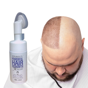 Solution d'entretien et de repousse de la densité des cheveux pour hommes Produit de beauté et de soins personnels pour la récupération des cheveux clairsemés - Product Image 1
