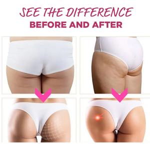 Chinaherbs BBL Butt Booster Gummies : Complément Alimentaire Beauté BBL Maca Vitamines pour Raffermir et Rehausser les Hanches et Fesses, Gummies pour des Fesses et des Hanches Plus Volumineuses - Product Image 3