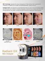 Appareil de scanner facial DX pour la détection et l'analyse des problèmes cutanés potentiels tels que l'acné, utilisé pour le diagnostic facial