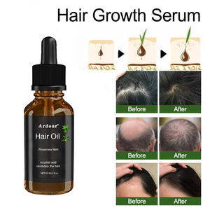 น้ำมันโรสแมรี่และน้ำมันละหุ่งธรรมชาติ สำหรับบำรุงเส้นผมและหนังศีรษะ ช่วยเร่งการเจริญเติบโตของเส้นผม สำหรับทั้งผู้ชายและผู้หญิง - Product Image 2