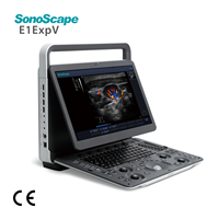 Échographe vétérinaire portable SonoScape Ultrasound E1 ExpV, Doppler couleur, E1 Exp pour l'imagerie diagnostique animale