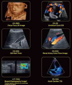 Échographe <span class=keywords><strong>portable</strong></span> <span class=keywords><strong>Edan</strong></span> Ax8 Doppler couleur Neuf Prix Ax3/Ax4/Ax8 - Product Image 5