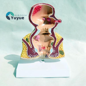 Model pengajaran medis Model vegetarian ambeien anal untuk pendidikan prokologi - Product Image 1