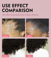 Huile de Croissance et Beurre Capillaire Traitant Logo Personnalisé pour une Repousse et des Cheveux Plus Épais, Étiquette Privée pour Femmes Noires