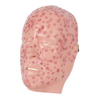 Máscara de silicona de maniquí para entrenamiento médico: modelo de exhibición facial de viruela severa