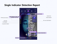Máquina Analizadora de Piel 3D Inteligente 2025, Actualización Mo Upgrade Max, Analizador de Piel con IA, Escáner Facial, Analizador de Acné Facial con IA