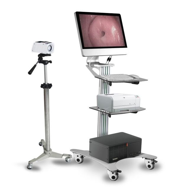 Hospital Gynecological Examination Equipment Digital Optical Colposcope System for Vaginal Testing