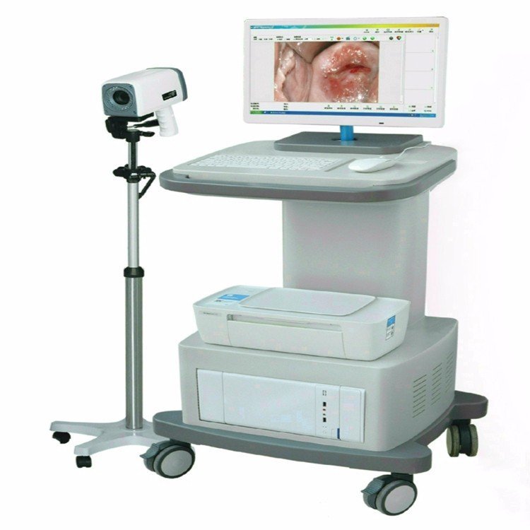 Electronic Colposcope Digital Electronic Gynecology Colposcope Digital Video Colposcope
