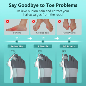Factory Sale <strong>Bunion</strong> Corrector Adjustable Valgus <strong>Bunion</strong> Corrector Big Toe for Night Thumb <strong>Protector</strong> - Product Image 4
