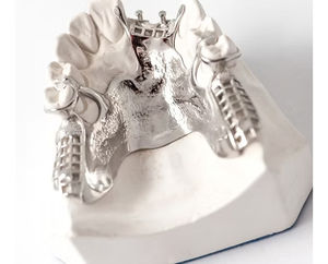 Resina Dental BlueCast para Impresora 3D LCD, 0.5 kg, Precisión Extrema, Estabilidad Dimensional, Italia - Product Image 4