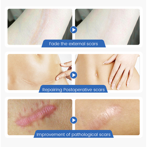 Gel phục hồi da cao cấp, tự nhiên, trị mụn, vết thâm, rạn da, làm mờ sẹo - Product Image 2