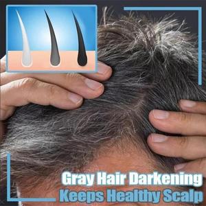 <span class=keywords><strong>Shampoing</strong></span> Solide Noir pour <span class=keywords><strong>Cheveux</strong></span> Shouwu, Savon Naturel Biologique à Base d'Huiles Essentielles, Anti-Chute de <span class=keywords><strong>Cheveux</strong></span>, Anti-Démangeaisons - Product Image 6