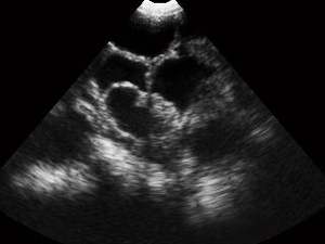 Vétérinaire <span class=keywords><strong>Usg</strong></span> Midray <span class=keywords><strong>Usg</strong></span> Machine pour le diagnostic abdominal <span class=keywords><strong>Usg</strong></span> - Product Image 6