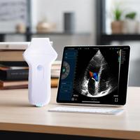 Konted MDR 128 elemen Harga pemindai Ultrasound, pemindai warna nirkabel genggam portabel